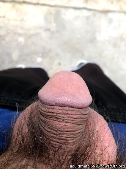 Photo of a penile from liquidmetal69