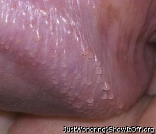 Pearly papules - extreme closeup