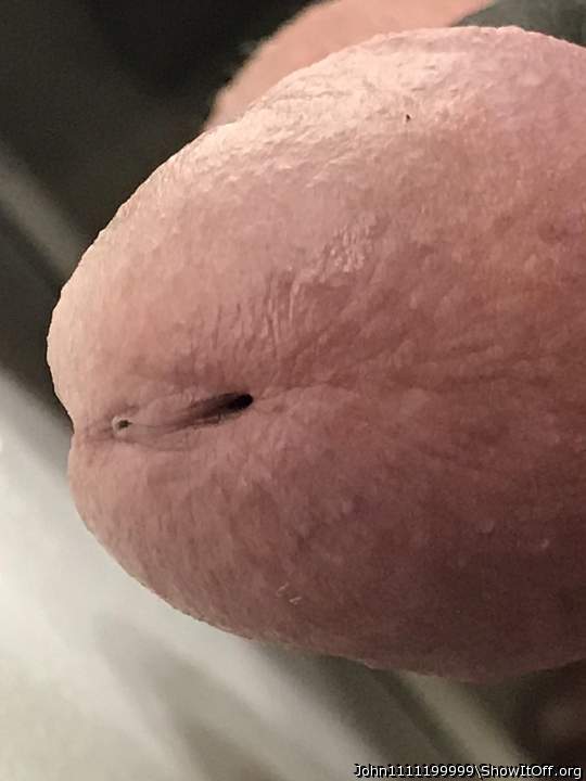 Photo of a penile from John1111199999