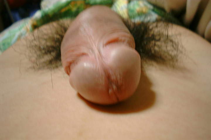 Photo of a penile from ken