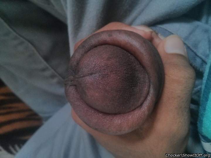 Photo of a penis from chocker