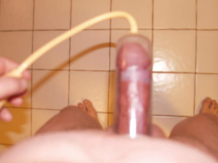 Photo of a penis from padda