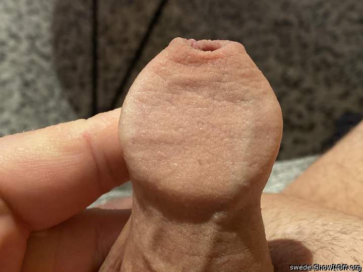 Game: Whats under the foreskin?
