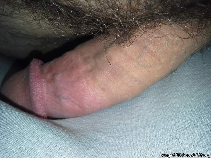 Photo of a penis from winger250
