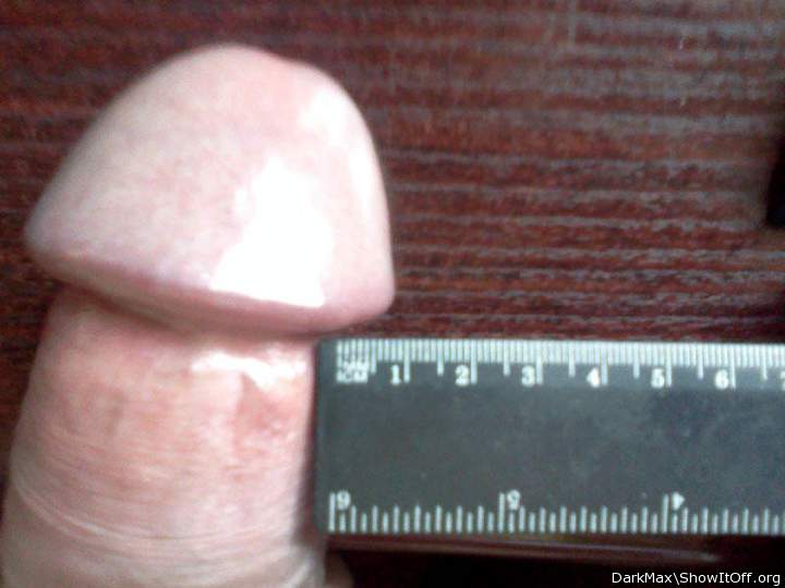 Corolla of penis: 1 cm