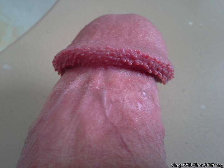 I am in awe of your pearly papules. My tongue tip wants to e