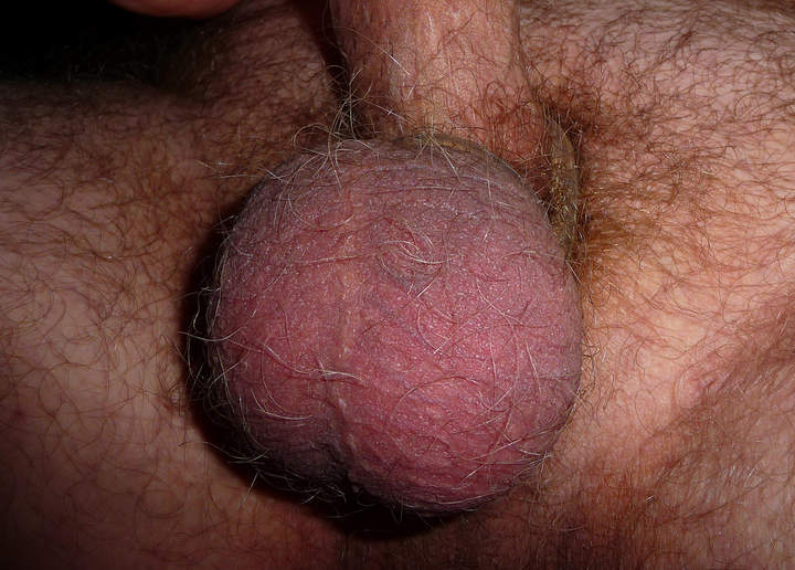 Testicles Photo from major