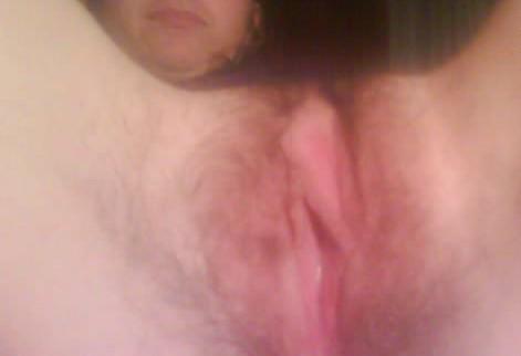 Photo of a penile from akai22