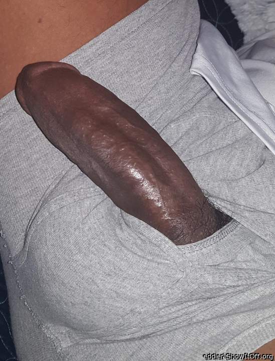 Photo of a penile from eddier