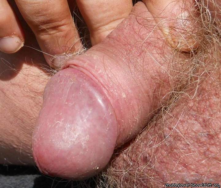 my old dick with uncovered head