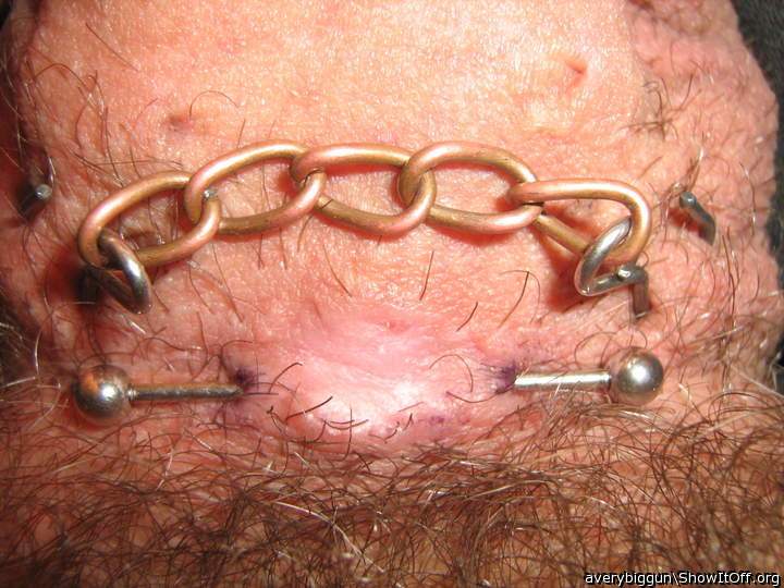 Replacement for ripped-out piercing at root of cock