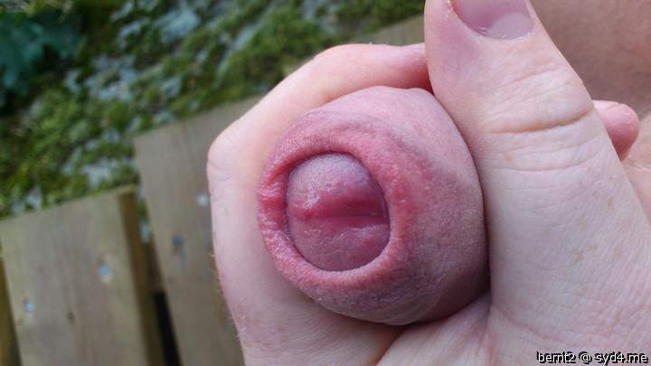Great foreskin!! The edges and the head underneath look very