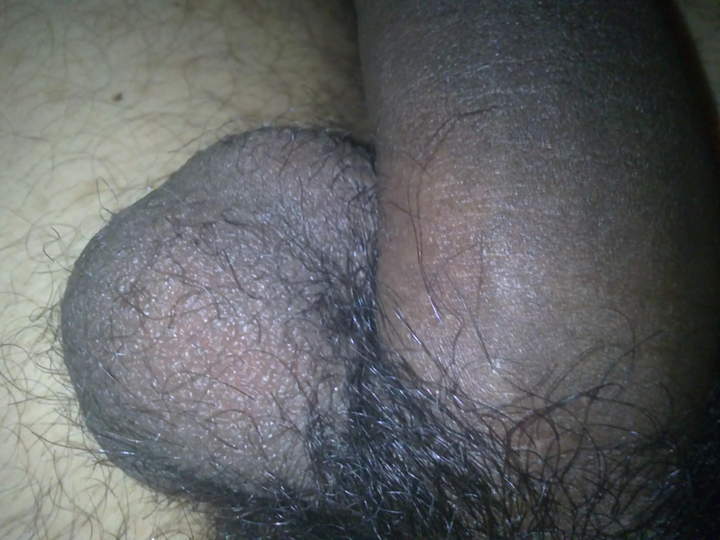 Photo of a penile from nicedices
