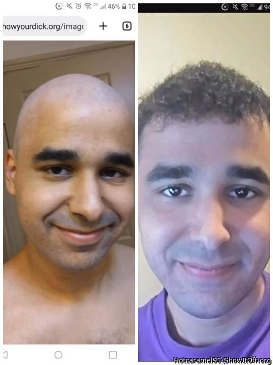 Do I look better bald or with hair?