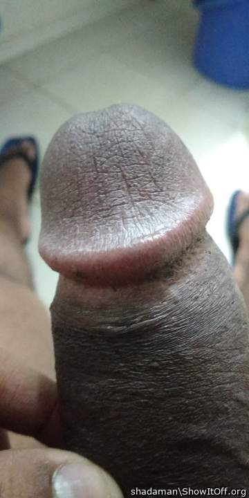 Photo of a penile from shadaman