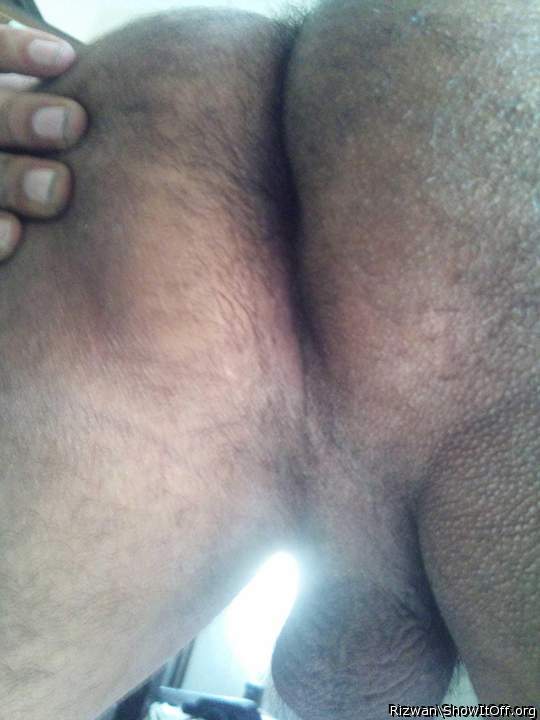 Photo of a penile from Rizwan