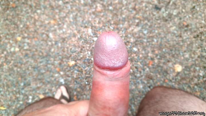 Photo of a phallus from winger70