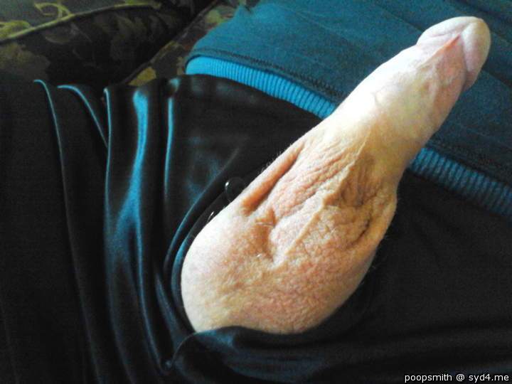Photo of a middle leg from PoopSmith