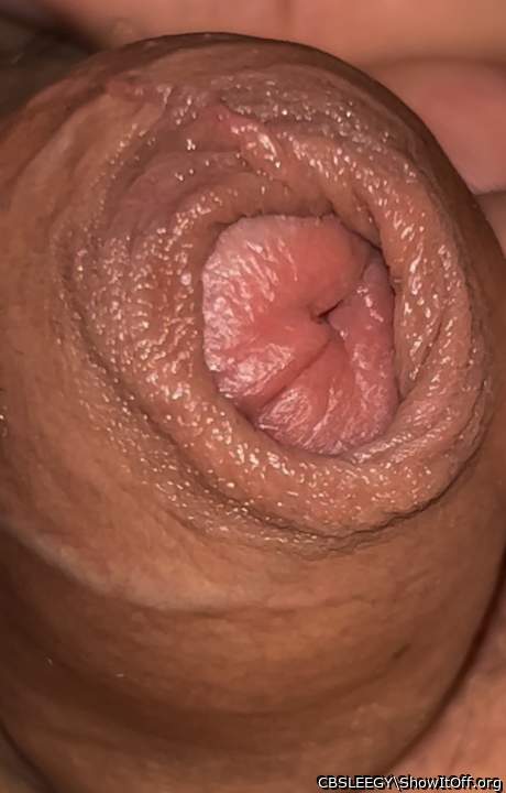 Foreskin and hole dont line up properly..