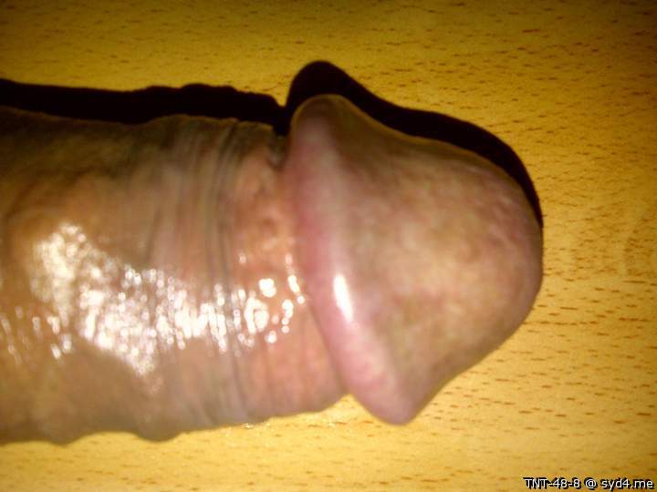 Photo of a penile from TNT-48-8