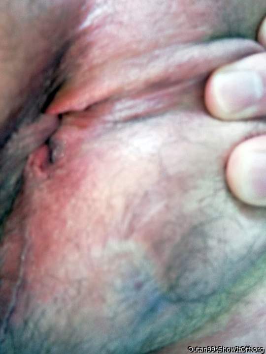 My ass hole 2