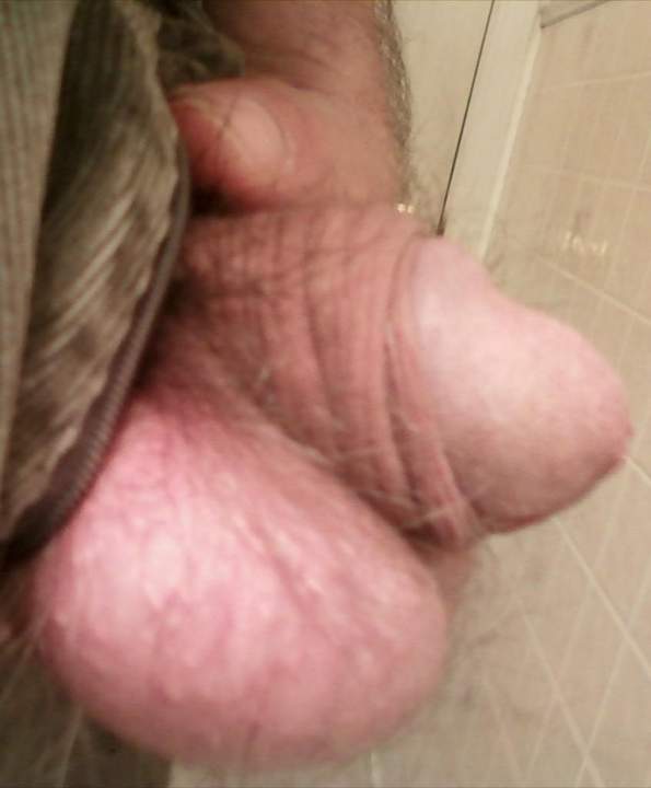 Photo of a penile from JustWondring