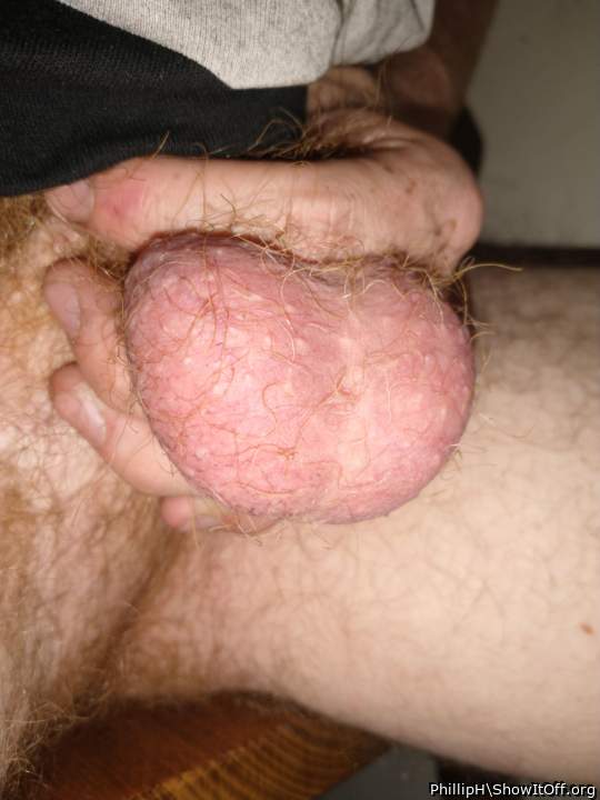Testicles Photo from PhillipH