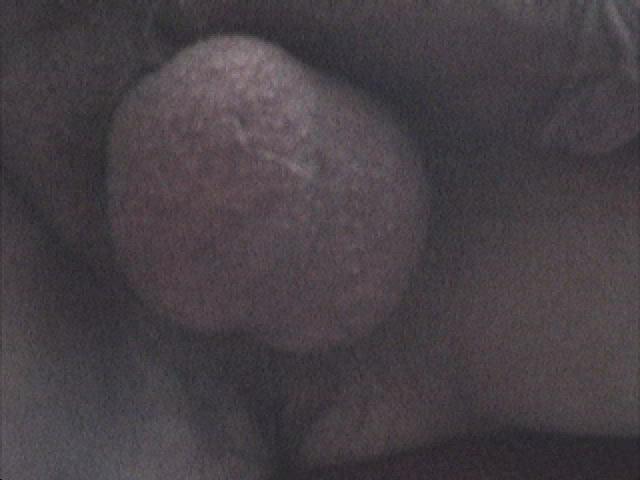 Testicles Photo from polloiw