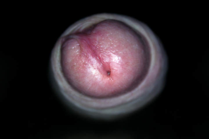 Photo of a schlong from babarch
