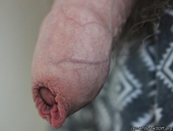 Foreskin view