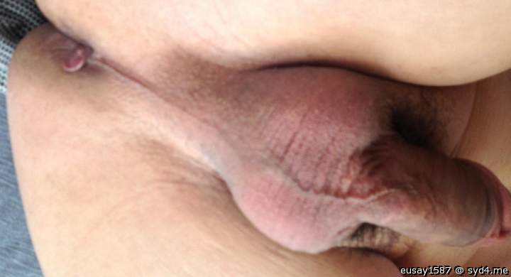 Testicles Photo from eusay1587