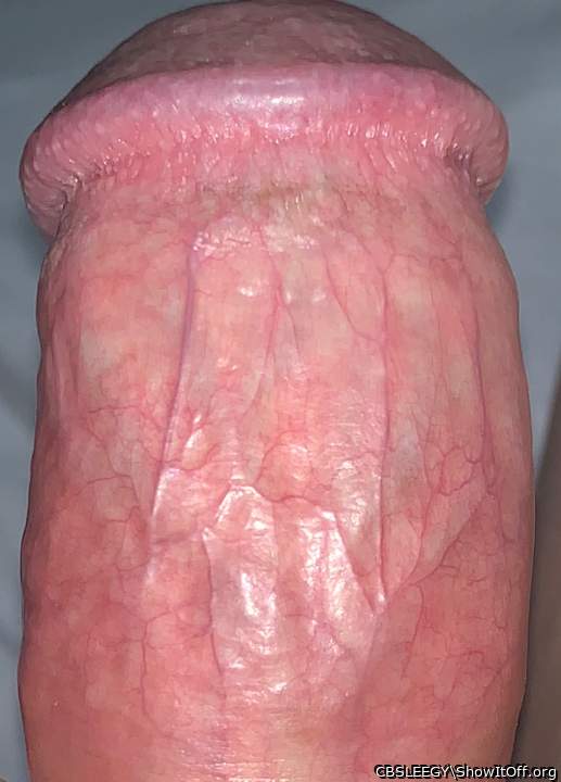 Veins Galore!