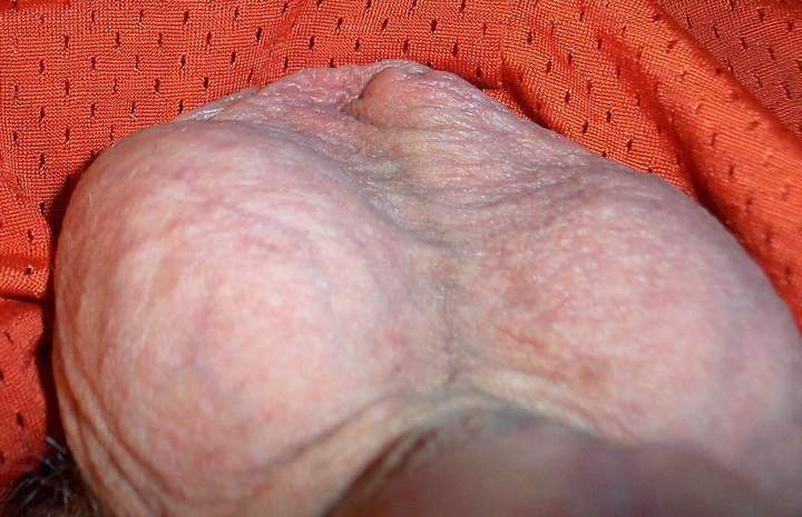 Testicles Photo from lilsoftee