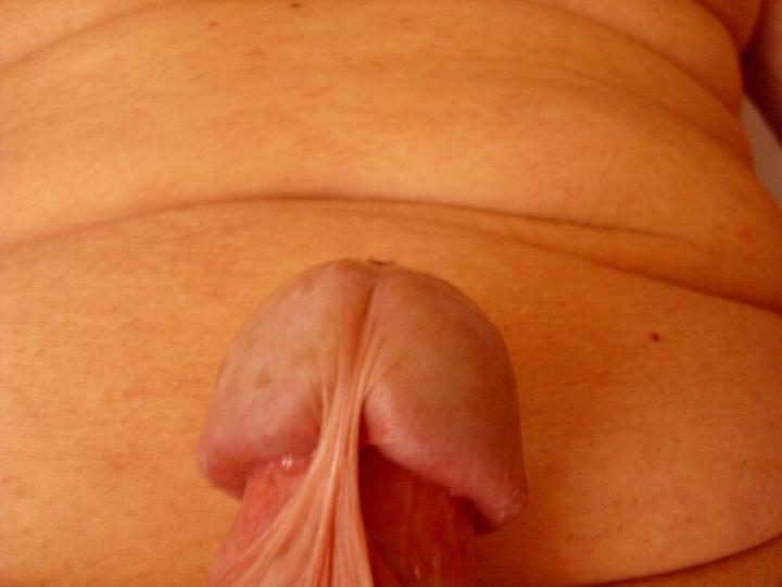 Awesome frenulum pic