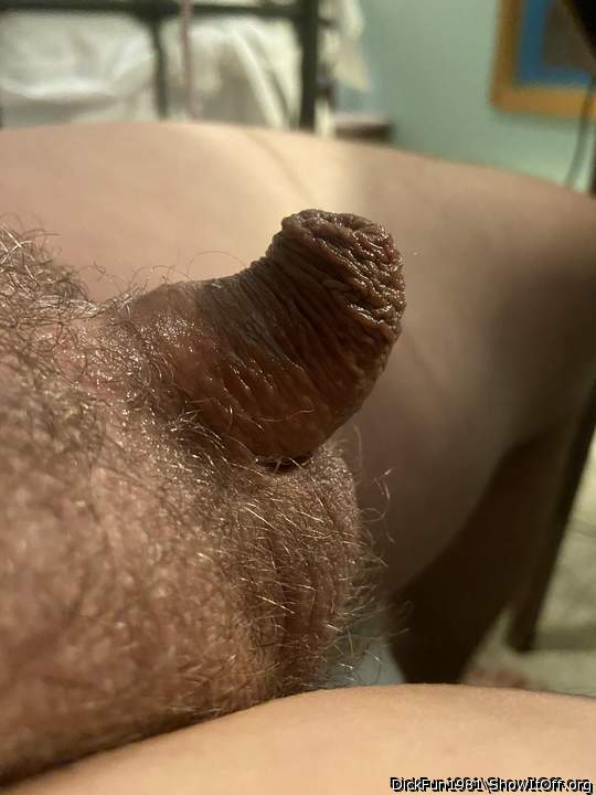 wow, amazing foreskin 