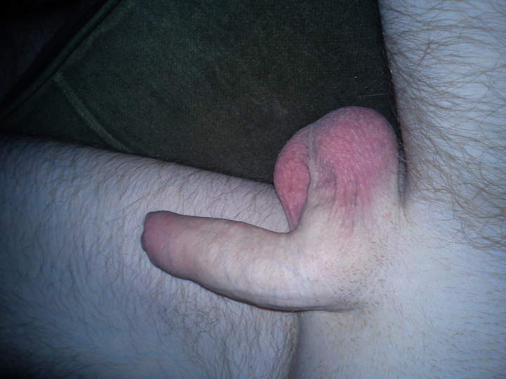 Photo of a penile from mack101