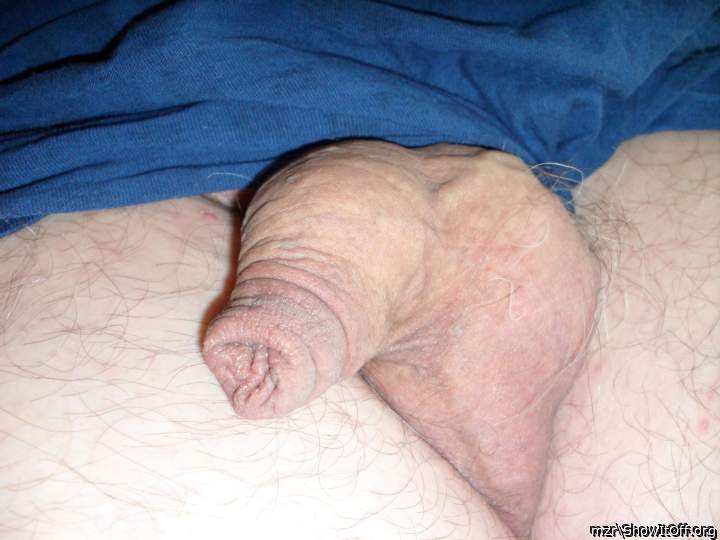 Uncut foreskin closeup
