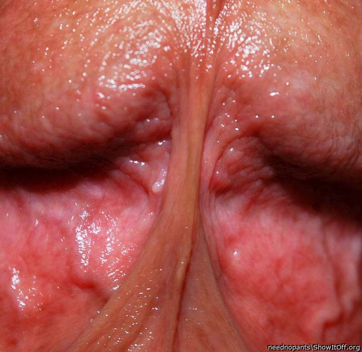 Beautiful closeup of the frenulum !