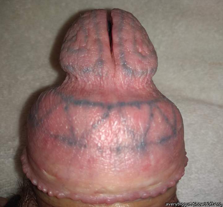 Foreskin Stretched Over Former