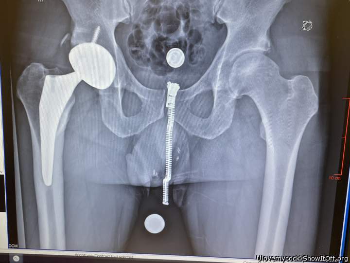 X RAY COCK!