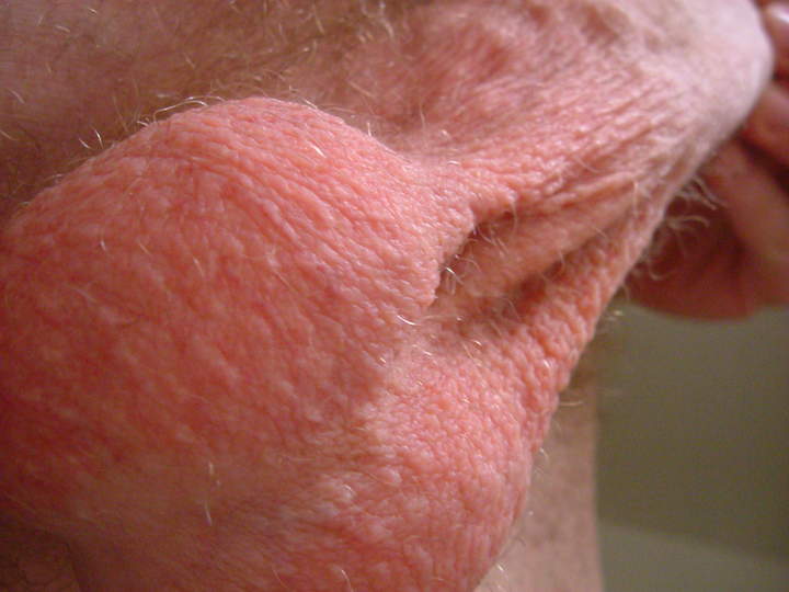 Testicles Photo from recordslave