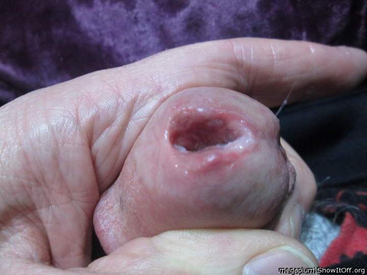After the pull out