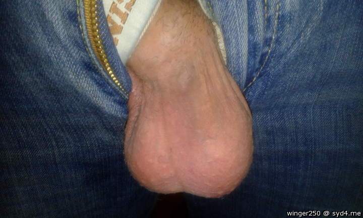 Testicles Photo from winger250