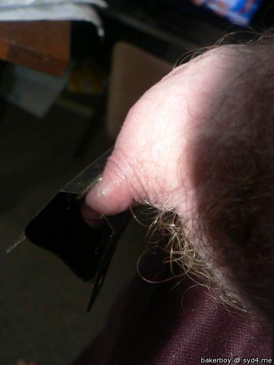 Photo of a penile from bakerboy