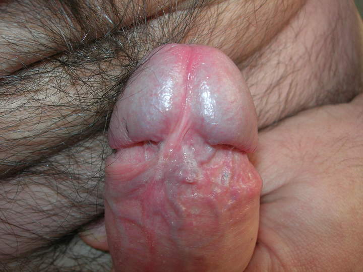 Photo of a bald-headed mouse from winger70