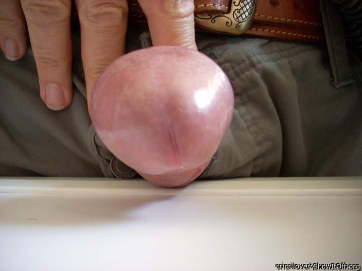 My glans before circumcision and opening