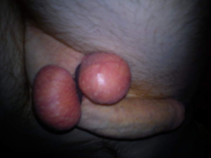 Testicles Photo from mack101
