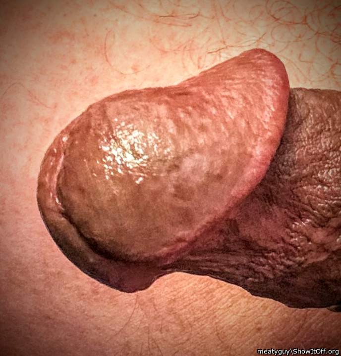 Photo of a prick from meatyguy