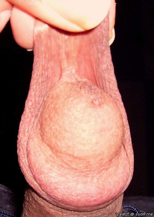 Photo of a third leg from greatct