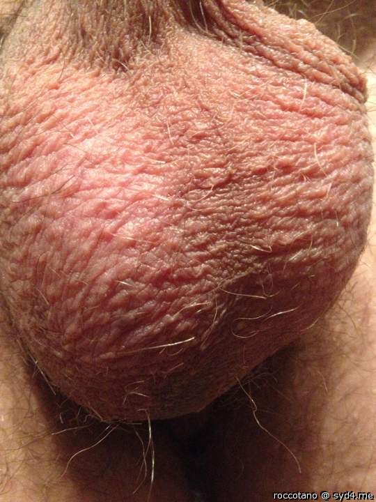 Testicles Photo from roccotano